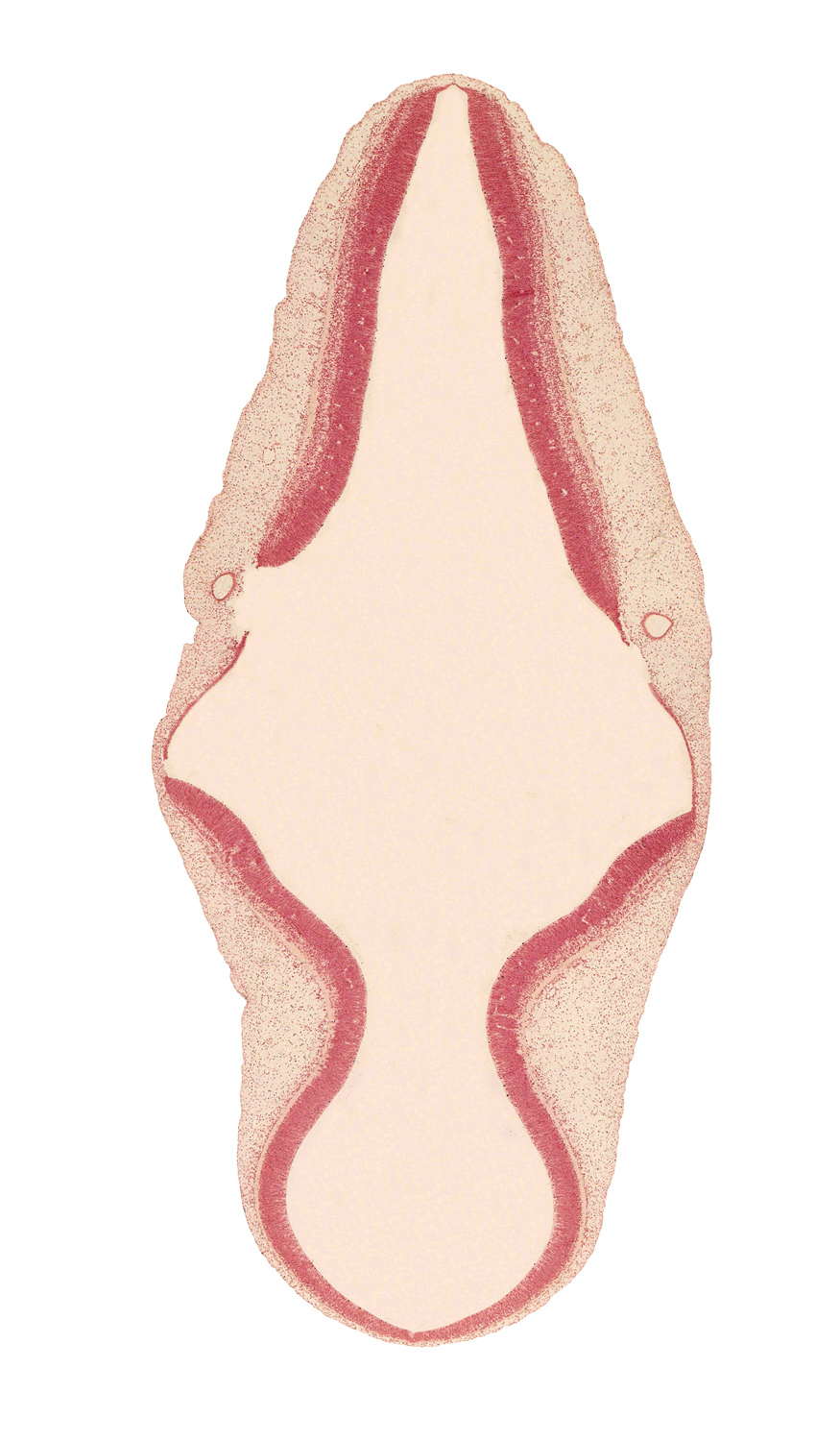 alar plate(s), artifact separation(s), head mesenchyme, isthmus of rhombencephalon, mesencephalon (M2), metencephalon, myelencephalon, roof plate, sulcus limitans, surface ectoderm, trochlear nerve (CN IV)