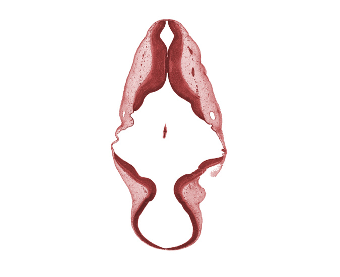 accessory nerve (CN XI), alar plate(s), artifact separation(s), basal plate, caudal edge of infolded roof plate of rhombencephalon, endolymphatic duct, junction of mesencoel and rhombencoel (fourth ventricle), mesencoel (cerebral aqueduct), myelencephalon, rhombencoel (fourth ventricle), roof plate, roof plate of myelencephalon, roof plate of rhombencephalon, root of vagus nerve (CN X), sulcus limitans, trochlear nerve (CN IV)