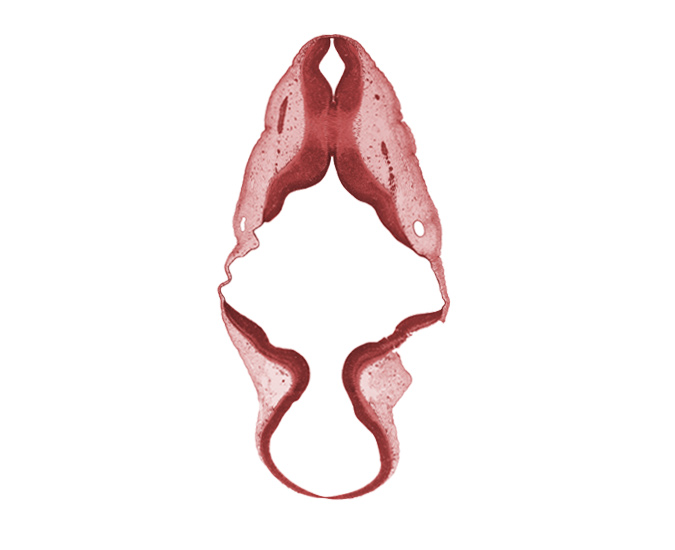 accessory nerve (CN XI), alar plate(s), mesencephalon, missing tissue (artifact), myelencephalon, roof plate, root of vagus nerve (CN X), sulcus limitans