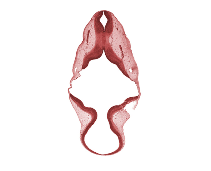 accessory nerve (CN XI), intermediate zone, marginal zone, mesencephalon (M2), missing tissue (artifact), otic capsule condensation, roof plate, root of vagus nerve (CN X), tectum, tegmentum, trochlear nerve (CN IV), ventricular zone