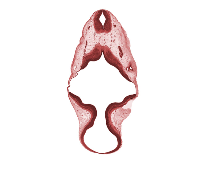 accessory nerve (CN XI), artifact(s), cephalic edge of C-1 spinal ganglion, junction of brain and spinal cord, mesencephalon (M2), mesencoel (cerebral aqueduct), region of cervical flexure, spinal accessory nerve (CN XI), sulcus limitans, trochlear nerve (CN IV), vagus nerve (CN X)