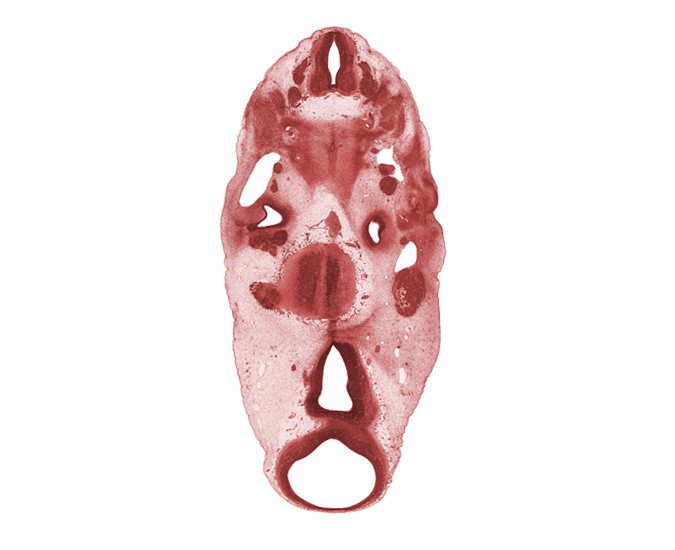 C-3 spinal ganglion, basal plate cartilage, dorsal primary ramus, epimere, geniculate ganglion (CN VII), inferior ganglion of glossopharyngeal nerve (CN IX), intermediate zone, mamillary region, marginal zone, mesencephalon (M1), mesencoel (cerebral aqueduct), motor root of trigeminal nerve (CN V), neural arch, notochord, precardinal vein, sclerotome, spinal accessory nerve (CN XI), third ventricle, vagus nerve (CN X)