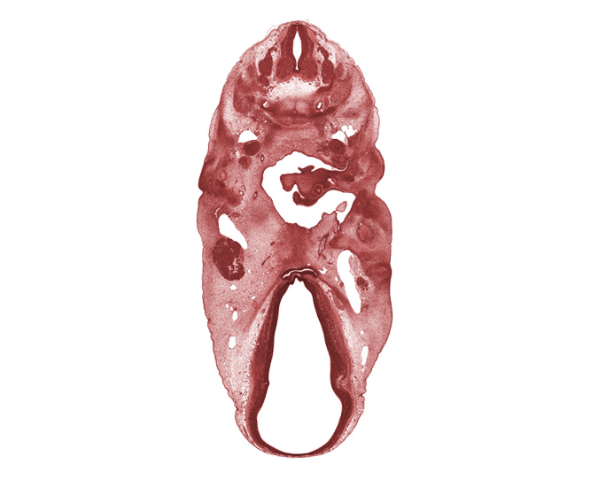 C-4 spinal ganglion, C-5 spinal ganglion, anterior dural venous plexus, basal plate condensation, cartilaginous vertebral centrum, dorsal sulcus, dural band for tentorium cerebelli, edge of otic capsule condensation, glossopharyngeal nerve (CN IX), intermediate zone, internal carotid artery, mandibular nerve (CN V₃), marginal zone, maxillary nerve (CN V₂), middle sulcus, ophthalmic nerve (CN V₁), orbitosphenoid condensation, oropharynx, pharyngeal pouch 2, primary head vein, third ventricle, trigeminal ganglion (CN V), tubotympanic recess (pharyngeal pouch 1), vagus nerve (CN X), ventral (hypothalamic) sulcus, ventricular zone