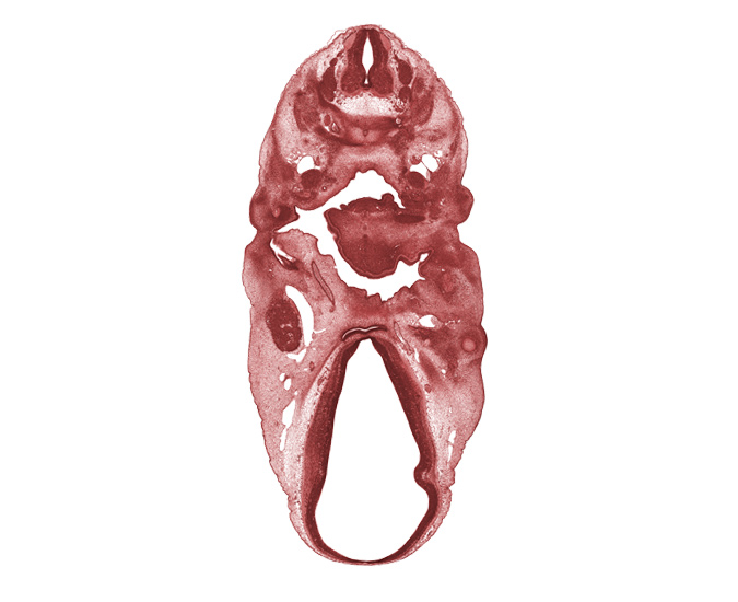 C-4 spinal ganglion, C-5 spinal ganglion, alisphenoid condensation, anterior dural venous plexus, auricular hillock, basisphenoid condensation, central canal, chorda tympani nerve, dorsal thalamus, edge of optic cup, epiglottis condensation, external acoustic meatus, hypothalamus, internal carotid artery, mandibular nerve (CN V₃), marginal ridge, maxillary vein, neural arch, oculomotor nerve (CN III), orbitosphenoid condensation, pharyngeal pouch 2, roof plate, supra-optic region, sympathetic trunk, terminal part of glossopharyngeal nerve (CN IX), vagus nerve (CN X), ventral thalamus