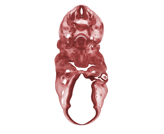 C-5 spinal ganglion, C-5 spinal nerve, C-6 spinal ganglion, auricular hillock, extrinsic tongue muscle(s), foramen cecum of tongue, head mesenchyme, hypoglossal nerve (CN XII), internal carotid artery, intraretinal space (optic vesicle cavity), lens, marginal ridge, meninx, optic cup cavity, optic stalk (CN II), optic stalk lumen (CN II), precartilage condensation of hyoid bone, sternocleidomastoid / trapezius muscle, vascular plexus