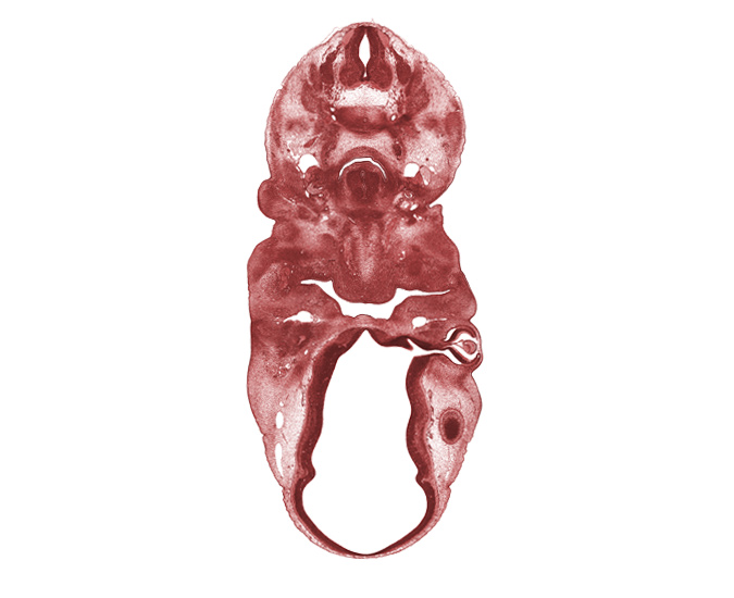 C-5 spinal nerve, C-6 spinal ganglion, diencephalon, edge of cerebral vesicle (telencephalon), epimere, external carotid artery, extrinsic tongue muscle (geniohyoid muscle), hyaloid vessel(s), hypoglossal nerve (CN XII), internal carotid artery, lens, neural arch, optic stalk lumen (CN II), pharyngeal condensation, precardinal vein, primordium of lateral palatine process, retinal fissure, third ventricle, vagus nerve (CN X), vertebral artery