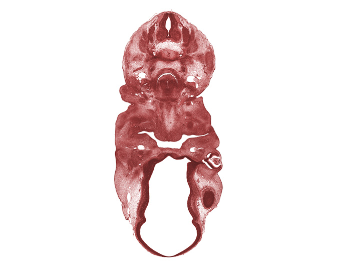 C-5 spinal nerve, C-6 spinal ganglion, central canal, corneal epithelium, epithelial lamina of larynx, hypoglossal nerve (CN XII), internal layer of retina, laryngeal condensation, mandibular prominence of pharyngeal arch 1, maxillary prominence of pharyngeal arch 1, meninx, missing tissue (artifact), oral cavity, oronasal cavity, precardinal vein, primary lens fiber, tongue