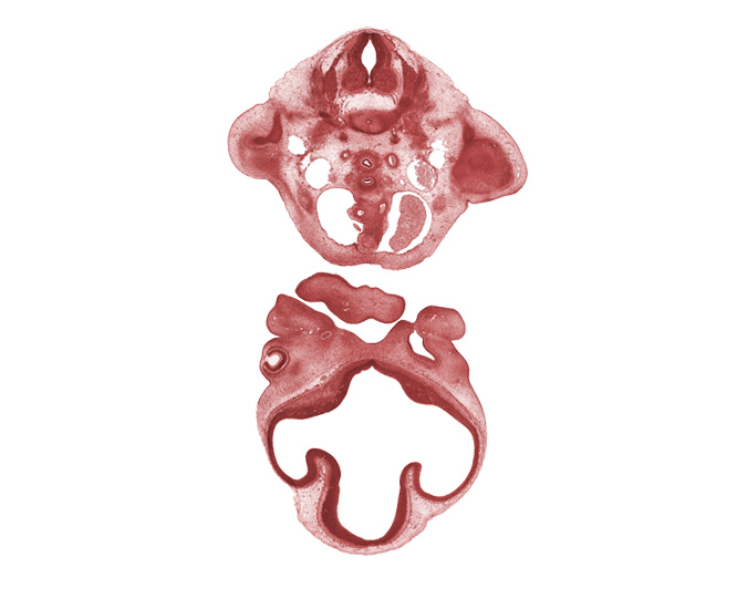 C-8 spinal ganglion, ascending aorta, central canal, dorsal aorta, esophageal condensation, interventricular foramen, junction of maxillary and medial nasal prominences, lateral ventricle, left atrium, nasal disc (olfactory placode), optic cup cavity, pulmonary trunk, shoulder region, sympathetic trunk, torus hemisphericus, tracheal condensation