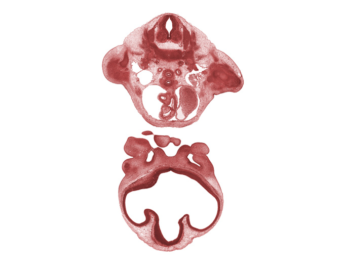 C-8 spinal ganglion, ascending aorta, axillary artery, cerebral vesicle (telencephalon), dorsal aorta, infundibulum of right ventricle, intermaxillary segment, intermediate zone, lateral ventricle, left vagus nerve (CN X), marginal zone, maxillary prominence of pharyngeal arch 1, nasal septal cartilage condensation, notochord, pericardial cavity, premuscle mass in arm, pulmonary trunk, third ventricle, torus hemisphericus, ventricular zone