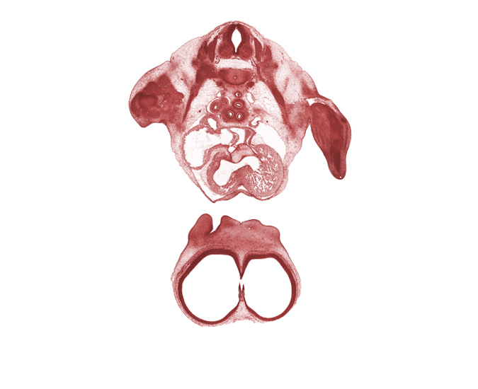 T-2 spinal ganglion, T-2 spinal nerve, aorta, atrioventricular endocardial cushion(s), atrioventricular sulcus, caudal edge of interventricular foramen, edge of interventricular foramen, interventricular foramen, interventricular sulcus, lateral nasal prominence, left horn of sinus venosus, left postcardinal vein, naris, phrenic nerve, primary interatrial septum (septum primum), right atrium, right postcardinal vein, sinus venosus