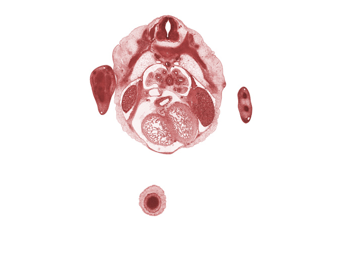 T-4 / T-5 interganglion region, aorta, central canal, communicating ramus, dorsal meso-esophagus, edge of cerebral vesicle(s), edge of frontal prominence, edge of mammary gland, esophagus endoderm, hand rays (metacarpal precartilages), heart prominence, inferior vena cava, intermediate zone, left horn of sinus venosus, left lobe of liver, marginal zone, pericardial cavity, peritoneal cavity, rib 5, right lobe of liver, sympathetic trunk