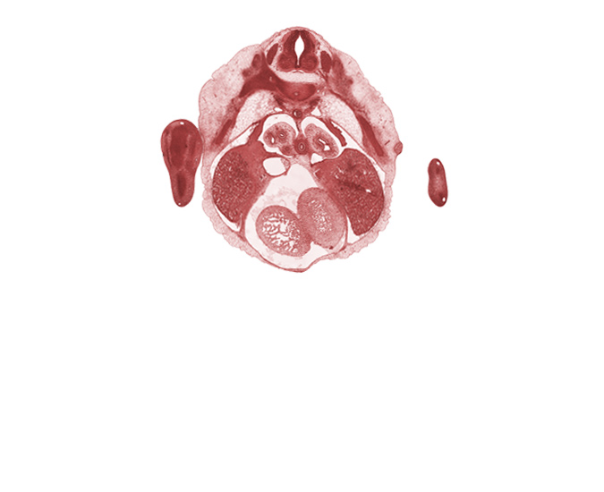 T-5 spinal ganglion, T-5 spinal nerve, aorta, dorsal meso-esophagus, heart prominence, left lobe of liver, mammary gland, marginal vein, pericardial cavity, pleuroperitoneal membrane, postcardinal vein, right lobe of liver, vascular plexus