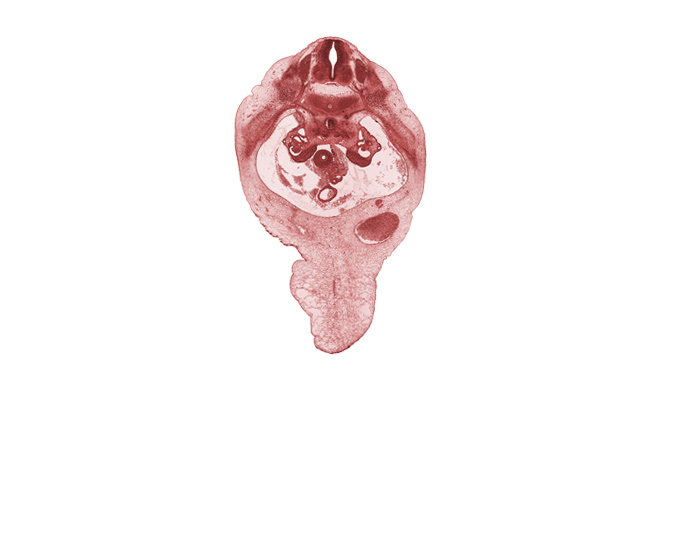 T-11 intercostal nerve, T-11 spinal ganglion, T-11 spinal nerve, alar plate(s), basal plate, duodenum, floor plate, meninx, mucoid connective tissue, notochord, roof plate, sulcus limitans, superior mesenteric artery, superior mesenteric vein, umbilical cord, umbilical vein