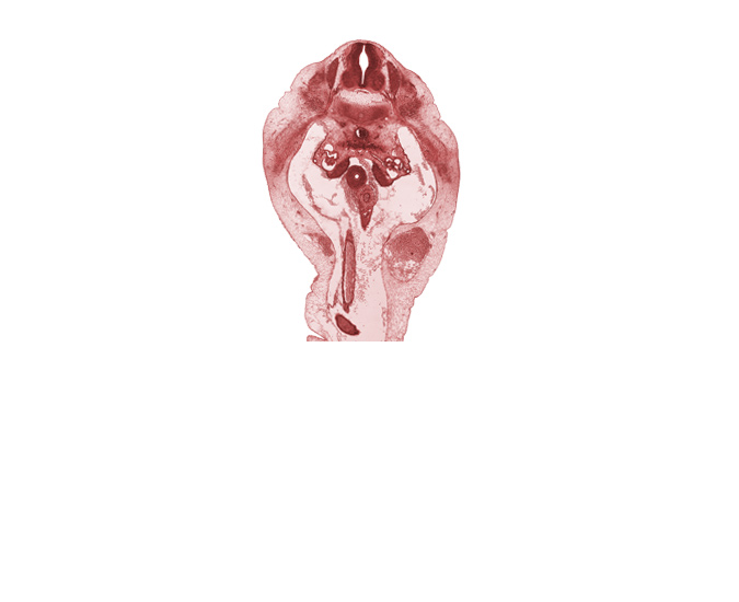 T-12 spinal ganglion, T-12 spinal nerve, blastemata of abdominal wall muscles, duodenum, edge of herniated midgut mesenchyme, epimere, gonadal ridge, mesonephric glomerulus, superior mesenteric artery, superior mesenteric vein