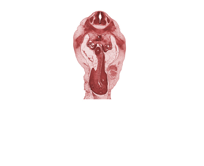 T-12 spinal ganglion, aorta, distal limb of herniated midgut, duodenum, midgut mesentery, proximal limb of herniated midgut, subcostal nerve (T-12), superior mesenteric artery, umbilical vein