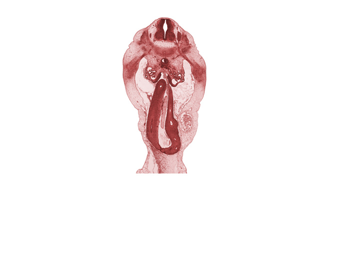 L-1 spinal ganglion, L-1 spinal nerve, aorta, caudal edge of superior mesenteric artery, cecum, distal limb of herniated midgut, duodenum, mesenchyme in mesentery of herniated midgut, mesonephric vesicle(s), proximal limb of herniated midgut, umbilical coelom, umbilical vein