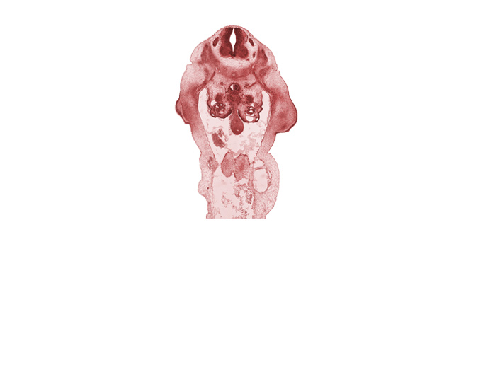 L-1 / L-2 interganglion region, L-1 spinal ganglion, L-2 spinal ganglion, L-2 spinal nerve, aorta, communicating ramus, mesonephric duct, metanephrogenic blastema, mucoid connective tissue, peritoneal cavity, postcardinal vein, umbilical coelom, umbilical vein, wall of umbilical artery