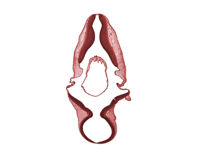 basal plate, edge of root of accessory nerve (CN XI), exterior of embryo, head mesenchyme, myelencephalon, root of trochlear nerve (CN IV)