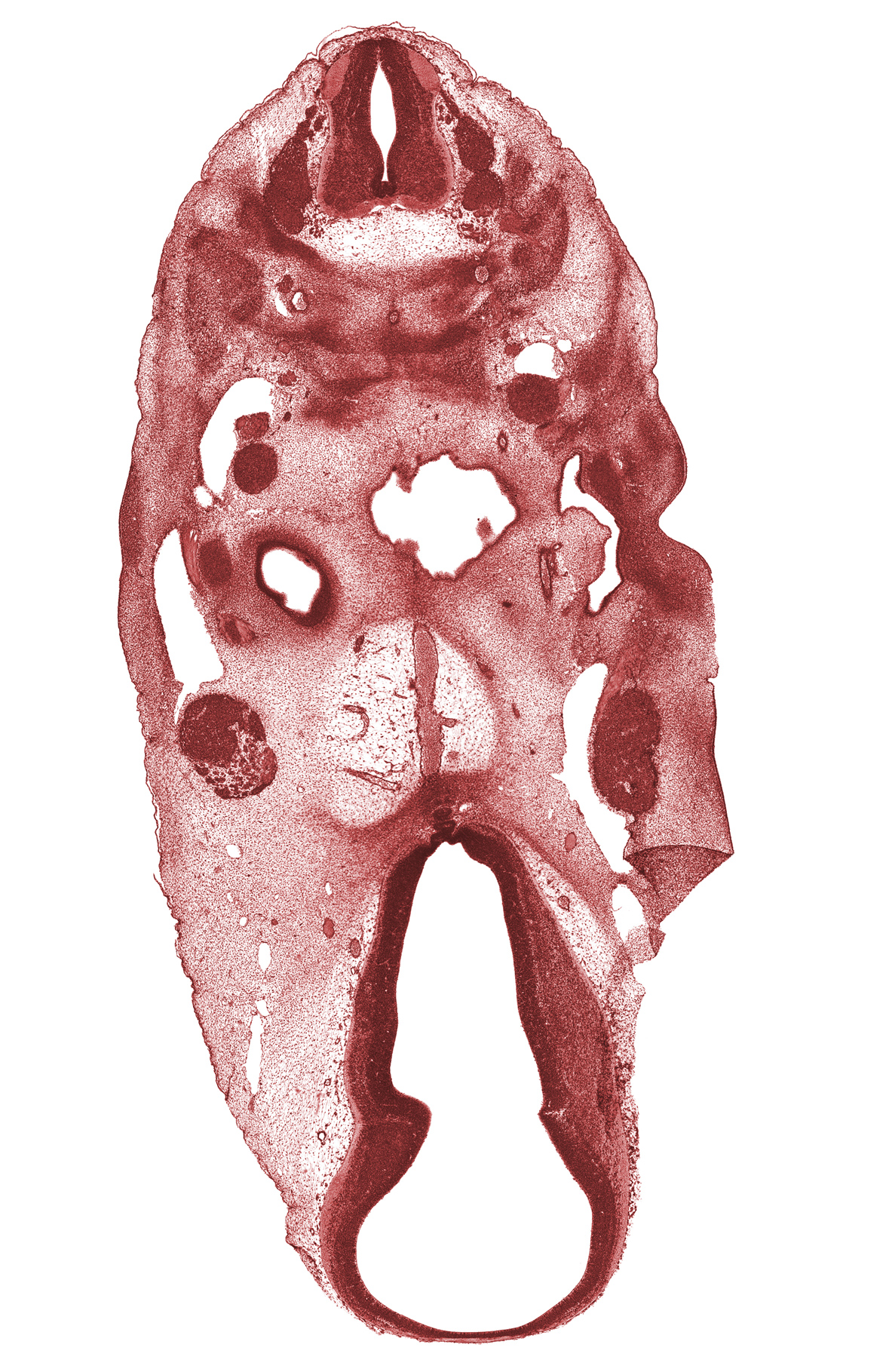 C-3 spinal ganglion, C-4 spinal ganglion, anterior dural venous plexus, basal plate condensation, basilar artery, dural limiting layer, edge of oronasal cavity, glossopharyngeal nerve (CN IX), inferior ganglion of vagus nerve (CN X), missing tissue (artifact), neurohypophyseal bud, notochord, oculomotor nerve (CN III), pharyngeal groove 1, spinal accessory nerve (CN XI), subarachnoid space, tissue fold (artifact), trigeminal ganglion (CN V), vertebral artery