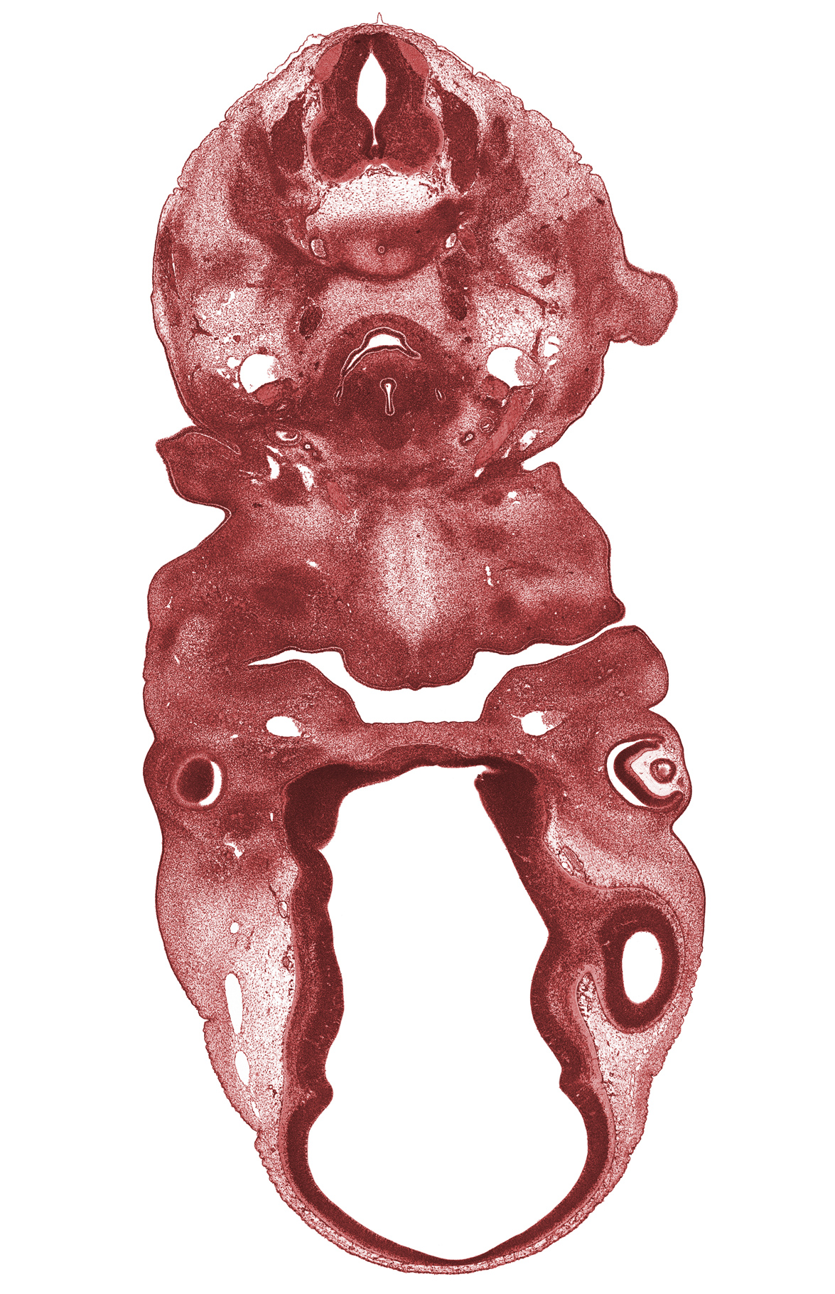 C-6 spinal ganglion, C-6 spinal nerve, C-7 spinal ganglion, aortic arch 4 (aortic arch), brachial plexus, central canal, edge of optic cup, lamina terminalis, maxillary prominence of pharyngeal arch 1, maxillary vein, optic stalk lumen (CN II), pre-optic area, precardinal vein, primordial oral vestibule, primordial palatine shelf, right common carotid artery, shoulder region, sympathetic trunk, telencephalon, thymus gland, transition region