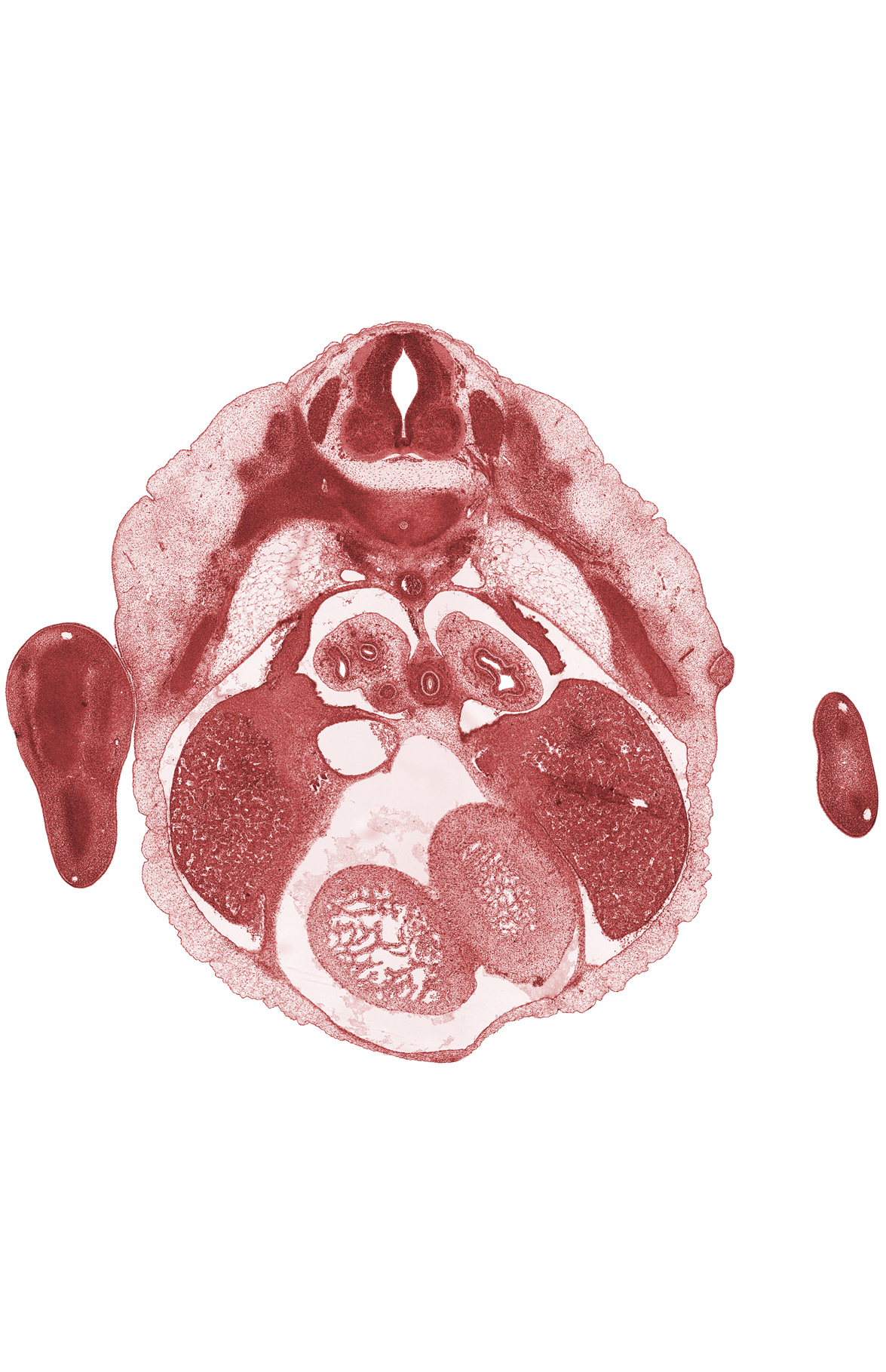 T-5 spinal ganglion, T-5 spinal nerve, aorta, dorsal meso-esophagus, heart prominence, left lobe of liver, mammary gland, marginal vein, pericardial cavity, pleuroperitoneal membrane, postcardinal vein, right lobe of liver, vascular plexus