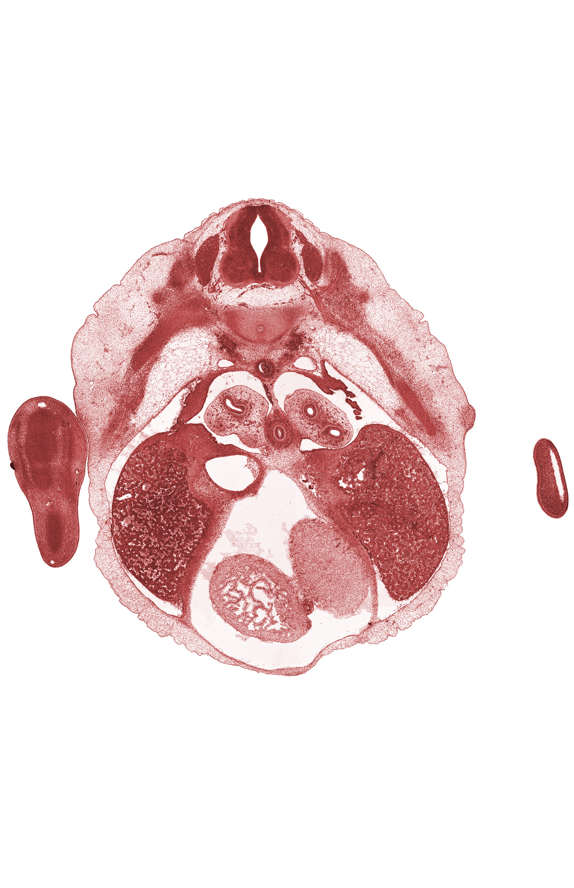 T-5 intercostal nerve, T-5 spinal ganglion, dorsal meso-esophagus, inferior vena cava, interventricular sulcus, left ventricle, lower secondary bronchus, mammary gland, marginal vein, pericardial cavity, pneumogenic coat, right lobe of liver, septum transversum, tertiary bronchopulmonary buds in lower lobe of left lung, trabecular part of right ventricle