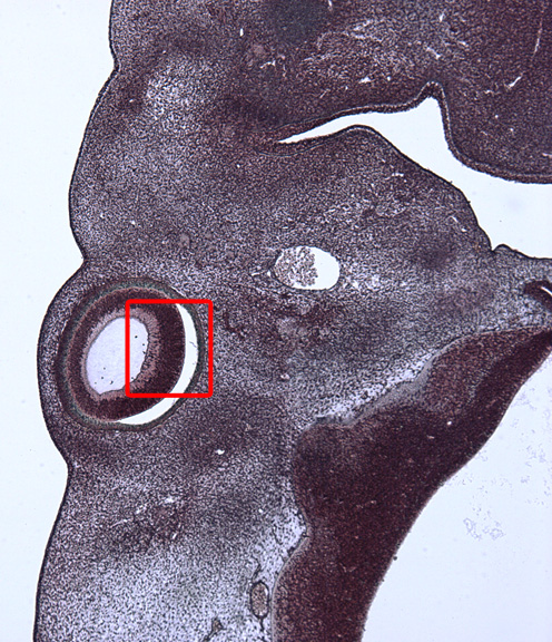 Location of the micrograph