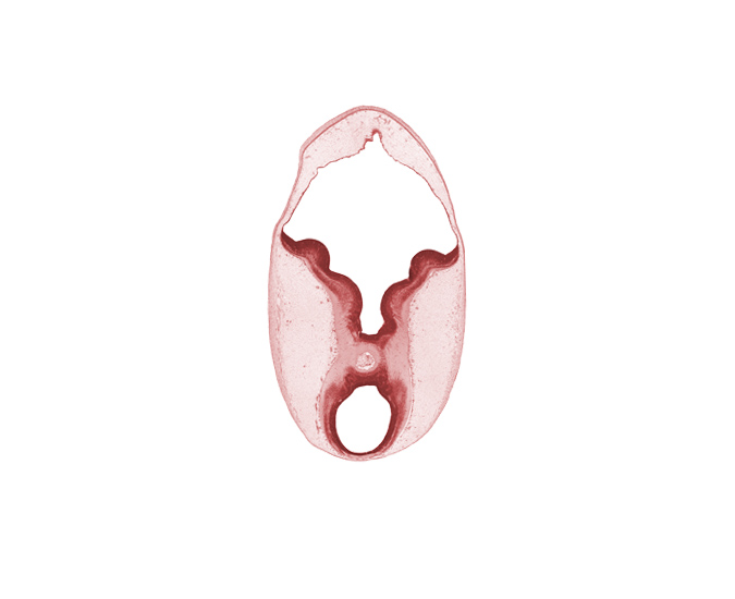 cerebral peduncle, commissure, edge of diverticulum of rhombencoel (fourth ventricle), intermediate zone, interpeduncular fossa, isthmic recess, junction of mesencephalon and metencephalon, marginal zone, osteogenic layer, rhombencoel (fourth ventricle), sulcus limitans, trochlear nerve (CN IV), ventricular zone