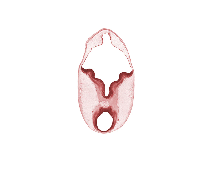 cerebral peduncle, diverticulum of rhombencoel (fourth ventricle), head mesenchyme, intermediate zone, interpeduncular fossa, marginal zone, mesencephalon, osteogenic layer, rhombencoel (fourth ventricle), subarachnoid space, surface ectoderm, vascular plexus, ventricular zone