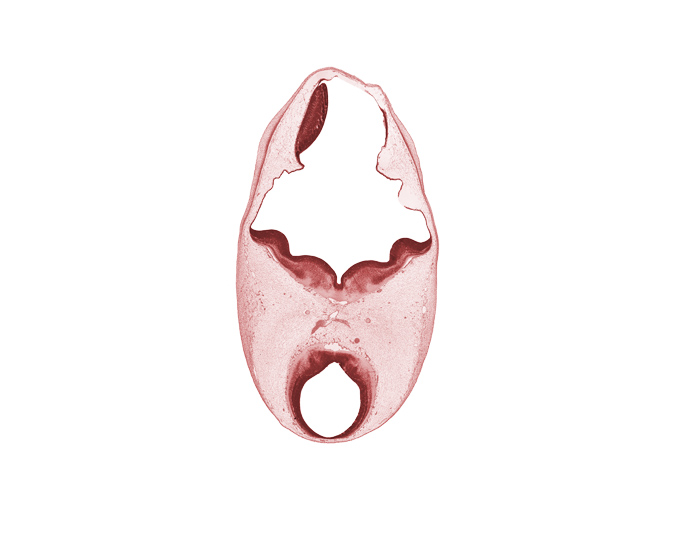 artifact separation(s), head mesenchyme, mesencephalon (M1), oculomotor nerve (CN III), osteogenic layer, posterior cerebral artery, subarachnoid space, surface ectoderm, termination of basilar artery, trochlear nerve (CN IV)