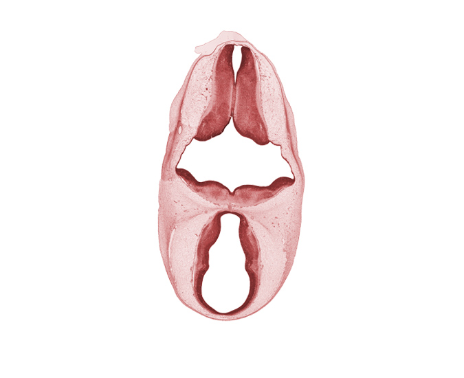 dorsal sulcus, dorsal thalamus, endolymphatic duct, epithalamus, hypothalamus, marginal ridge, osteogenic layer, rhombencoel (fourth ventricle), subarachnoid space, third ventricle, ventral thalamus