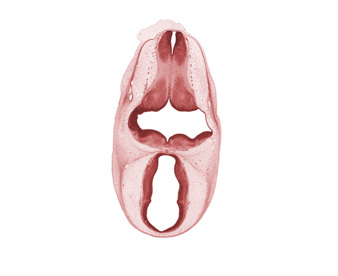 dorsal thalamus, head mesenchyme, hypothalamus, junction of metencephalon and myelencephalon, marginal ridge, median sulcus, myelencephalon (medulla oblongata), oculomotor nerve (CN III), osteogenic layer, pyramidal tract region, roof plate, surface ectoderm, trochlear nerve (CN IV), ventral thalamus