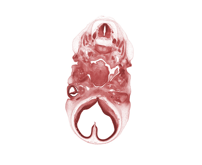 C-1 / C-2 intervertebral disc, C-2 spinal ganglion, C-2 spinal nerve, accessory nerve (CN XI), archipallium, basisphenoid condensation, blastema of extra-ocular muscle(s), blastemata of mastication muscles, cerebral vesicle (telencephalon), external acoustic meatus, facial nerve (CN VII), foramen cecum of tongue, inferior ganglion of vagus nerve (CN X), intraretinal space (optic vesicle cavity), junction of neural retina and optic stalk (CN II), neopallium, notochord, occipital lamina, optic cup cavity, optic stalk (CN II), paleopallium, precardinal vein, root of tongue, spinal accessory nerve (CN XI), vertebral artery