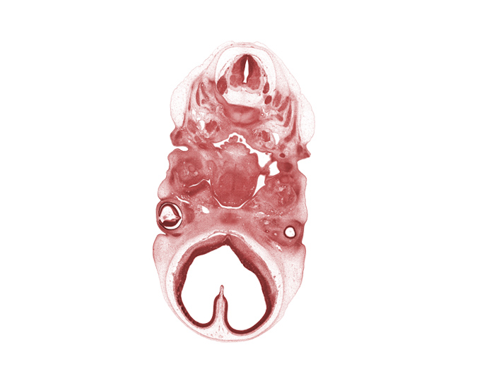 C-1 / C-2 intervertebral region, C-2 dorsal root, C-2 spinal ganglion, C-2 spinal nerve, C-3 spinal ganglion, basisphenoid condensation, centrum of C-2 vertebra (axis), edge of intraretinal space (optic vesicle cavity), external acoustic meatus, glossopharyngeal nerve (CN IX), hypoglossal nerve (CN XII), inferior ganglion of vagus nerve (CN X), maxillary venous plexus, neural arch of C-2 vertebra (axis), optic stalk (CN II), palatine shelf, precardinal vein, root of tongue, spinal accessory nerve (CN XI), telencephalon medium, vertebral artery