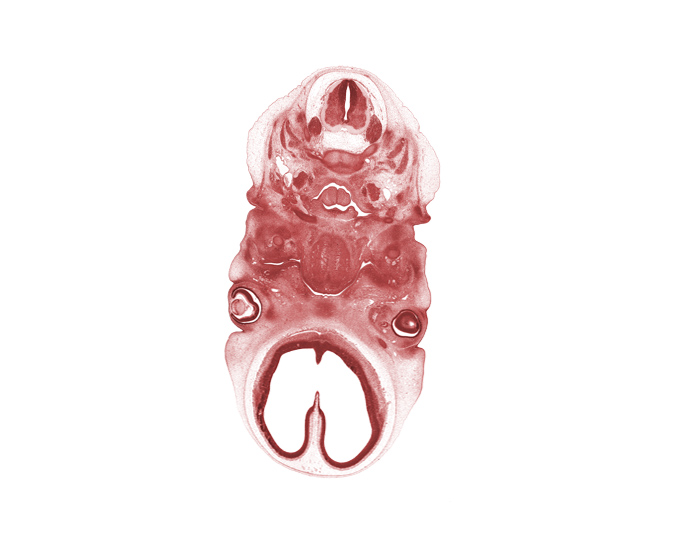 C-2 spinal nerve, C-3 dorsal root, C-3 spinal ganglion, auricle, blastemata of mastication muscles, centrum of C-2 vertebra (axis), cervical plexus, cornea, epiglottis, glossopharyngeal nerve (CN IX), interventricular foramen, laryngeal pharynx, larynx, lateral ventricle, lens, optic stalk (CN II), precartilage condensation of pharyngeal arch 2, spinal accessory nerve (CN XI)