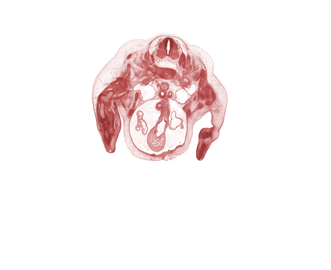 C-5 ventral primary ramus, C-6 / C-7 intervertebral disc, C-6 ventral primary ramus, C-7 dorsal primary ramus, C-7 spinal ganglion, C-7 spinal nerve, aorta, ascending aorta, dorsal surface of hand plate, esophagus, humerus, infundibulum of right ventricle, left atrium, notochord, precardinal vein, pulmonary artery, pulmonary semilunar valve, pulmonary semilunar valve cusp, right atrium, subclavian artery, trabecular part of right ventricle, trachea