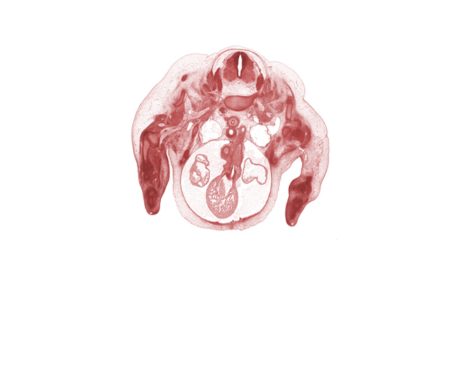 C-7 spinal ganglion, C-7 ventral primary ramus, aorta, ascending aorta, axillary artery, brachial plexus, carpus, central canal, dorsal fasciculus, hand ray, inferior cervical sympathetic ganglion, infundibulum of right ventricle, left atrium, left vagus nerve (CN X), pectoralis major muscle, precardinal vein, pulmonary semilunar valve, pulmonary trunk, retro-esophageal space, right atrium, right vagus nerve (CN X), subclavian artery, trabecular part of right ventricle, ventral horn of grey matter