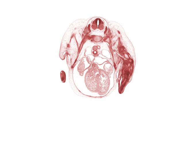 T-1 intercostal nerve, T-1 spinal ganglion, T-2 intercostal nerve, aorticopulmonary septum region, artifact fracture(s), axillary artery, central canal, head of rib 1, left atrium, left precardinal vein, left ventricle, musculi pectinati in right atrial wall, neural arch, phrenic nerve, retro-esophageal space, rib 2, rib 3, right precardinal vein, right ventricle, subarachnoid space, transverse sinus, undivided truncus arteriosus (proximal outflow tract)