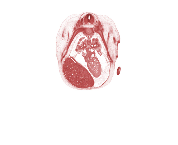 T-4 / T-5 interganglion region, apex of left ventricle, caudal edge of shoulder, central tendon of diaphragm, centrum of T-5 vertebra, edge of left atrium, edge of lower lobe of left lung, edge of lower lobe of right lung, lower lobe of left lung, lower secondary bronchus of left lung, mammary gland, middle lobe of right lung, muscular part of diaphragm, oblique fissure, pericardial cavity, peritoneal cavity, phrenic nerve, pleural cavity, rib 5, right lobe of liver, upper limb, upper lobe of left lung, upper secondary bronchus of left lung