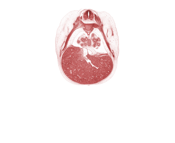 T-6 spinal ganglion, T-6 spinal nerve, anterior basal tertiary bronchus, common efferent hepatic vein, edge of lingula of upper lobe of left lung, edge of pericardial cavity, efferent hepatic veins, esophagus muscularis, head of rib 7, inferior vena cava, left efferent hepatic vein, lower lobe of right lung, osteogenic layer, peritoneal cavity, pleural cavity, rib 7, rib 8