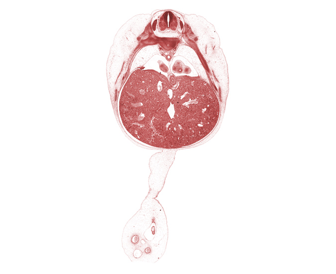 T-8 / T-9 intervertebral disc, T-8 intercostal nerve, T-8 spinal ganglion, allantois, dorsal meso-esophagus, ductus venosus, esophageal hiatus in diaphragm, left lobe of liver, left umbilical artery, lower lobe of left lung, lower lobe of right lung, muscular part of diaphragm, omphalomesenteric artery, pleuroperitoneal opening, rib 10, rib 9, right lobe of liver, right umbilical artery, umbilical coelom, umbilical cord, umbilical vein