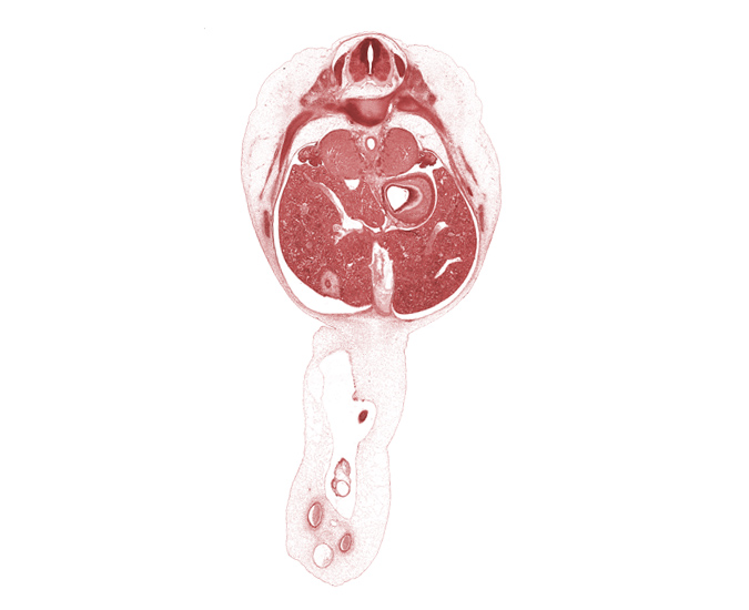 T-9 spinal ganglion, allantois, amnion on surface of umbilical cord, aorta, ductus venosus, edge of herniated midgut, fundus of stomach, gall bladder, head of rib 10, inferior vena cava, junction of ductus venosus and hepatic portal vein, left lobe of liver, left umbilical artery, mesonephric duct, paramesonephric groove, quadrate lobe of liver, rib 11, right umbilical artery, suprarenal gland cortex, surface ectoderm, umbilical vein