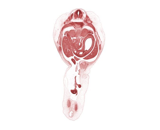 T-10 / T-11 interganglion region, T-11 / T-12 intervertebral disc, T-11 intercostal nerve, dorsal pancreas, duodenum, duodenum bulb, gonadal ridge, hepatic portal vein, left lobe of liver, left umbilical artery, lumen of body of stomach, mesentery of herniated midgut, midpoint of midgut, neural arch, omphalomesenteric artery, pyloric antrum of stomach, pylorus of stomach, right lobe of liver, right umbilical artery, superior mesenteric artery, suprarenal gland cortex, sympathetic trunk, umbilical vein