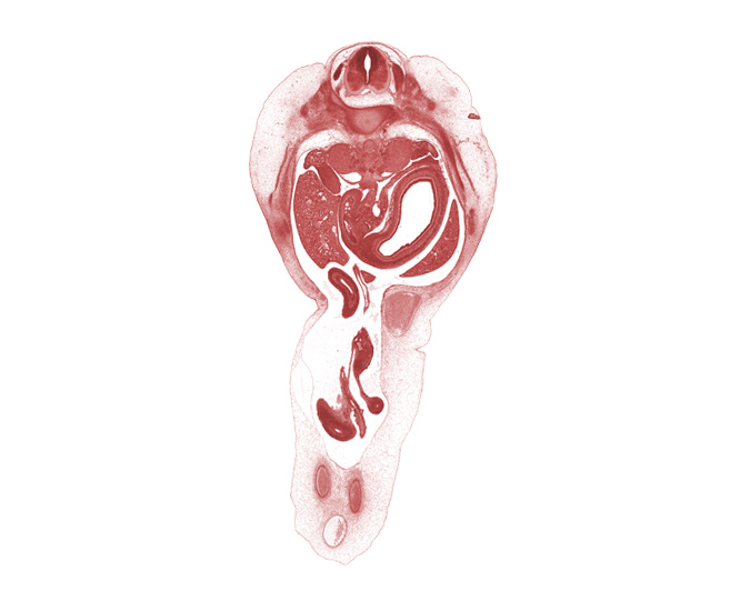 T-11 intercostal nerve, T-11 spinal ganglion, bile duct, blastemata of deep back muscles, caudal edge of quadrate lobe of liver, distal limb of herniated midgut, dorsal mesogastrium, duodenum (second part), gonadal ridge, hepatic portal vein, inferior vena cava, junction of omphaloenteric and superior mesenteric arteries, left lobe of liver, lesser sac (omental bursa), proximal limb of herniated midgut, pyloric antrum of stomach, right lobe of liver, superior mesenteric artery, umbilical vein