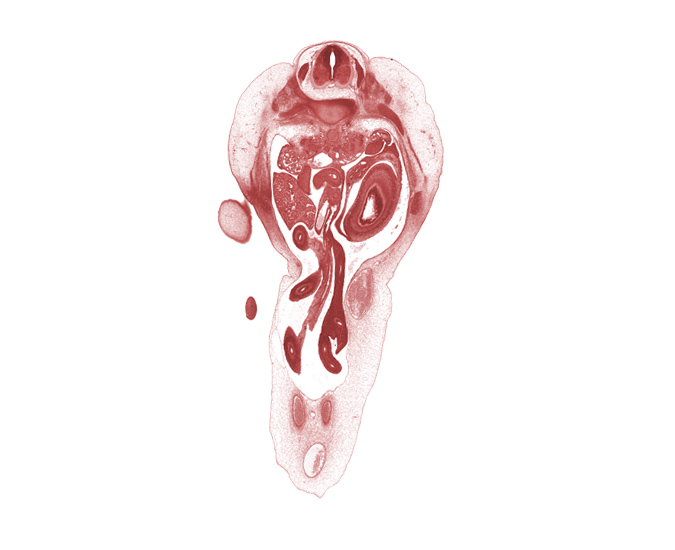 T-12 spinal ganglion, T-12 spinal nerve, allantois, blastemata of lateral abdominal wall muscles, cephalic edge of foot, cephalic edge of thigh, dorsal mesogastrium, duodenum (third part), greater curvature of stomach, left umbilical artery, midgut mesentery, ovary, proximal limb of herniated midgut, rib 12, right umbilical artery, spleen, superior mesenteric artery, superior mesenteric vein, umbilical vein, ventral horn of grey matter