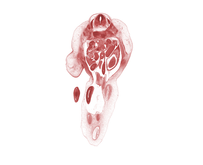 T-12 / L-1 intervertebral disc, T-12 spinal ganglion, allantois, amnion, caudal edge of stomach, dorsum of foot, duodenum (fourth part), edge of left umbilical artery, hindgut, inferior vena cava, left umbilical artery, lesser sac (omental bursa), mesonephros, mucoid connective tissue, ovary, proximal limb of herniated midgut, proximal limb of midgut, right umbilical artery, umbilical coelom, umbilical vein