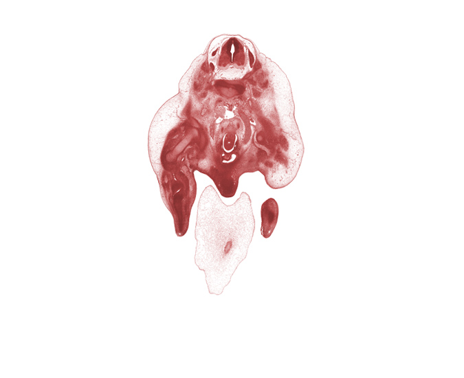 L-2 spinal ganglion, amnion on surface of umbilical cord, caudalmost section through umbilical vein, central canal, femur, glans clitoris, hindgut, left common iliac artery, left horn of urinary bladder, left umbilical artery, left ureter, median sacral nerve, mesonephric duct, osteogenic layer, primordial phallus, right ureter, surface ectoderm