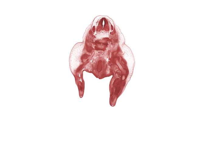 L-3 / L-4 interganglion region, L-3 spinal ganglion, L-4 spinal nerve, L-5 / S-1 intervertebral disc, L-5 ventral primary ramus, S-1 / S-2 intervertebral region, central vein of leg, cephalic edge of L-4 spinal ganglion, dorsal fasciculus, femur, knee joint, labial swelling, lumbosacral trunk, marginal vein, median sacral artery, neural process, rectum, sacral plexus, tibia, urethral fold, urethral groove