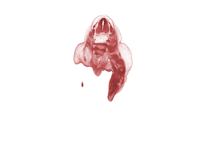 L-4 spinal ganglion, L-5 spinal nerve, S-1 / S-2 intervertebral region, S-1 ventral primary ramus, S-2 ventral primary ramus, S-3 / S-4 intervertebral region, S-3 ventral primary ramus, ala of sacrum, buttox region, caudal edge of lower limb, caudal eminence, cephalic edge of L-5 spinal ganglion, sciatic nerve, subarachnoid space