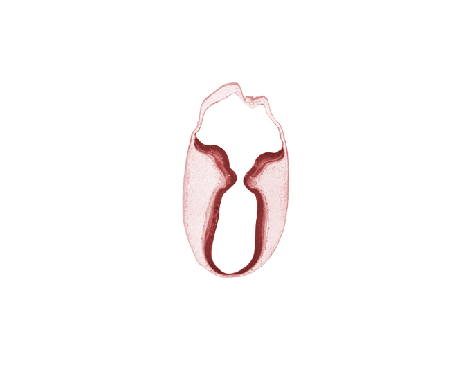 cerebral aqueduct (mesencoel), intermediate zone, isthmus of metencephalon, marginal zone, rhombencoel (fourth ventricle), trochlear nerve (CN IV), ventricular zone